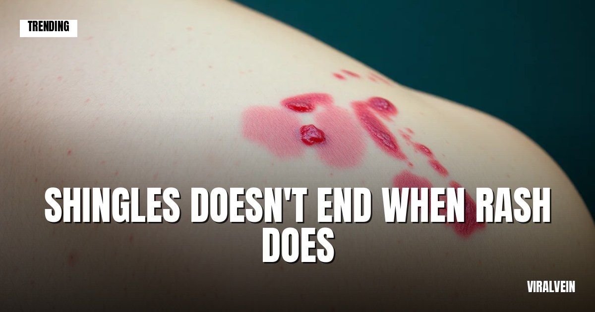 Shingles is way more serious than most people think